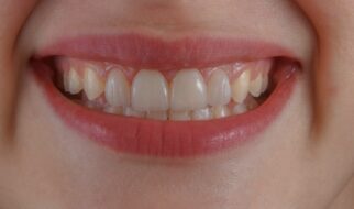 By the Skin of Your Teeth